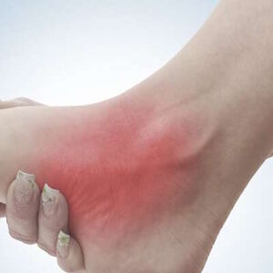 recovery-in-polyneuropathy